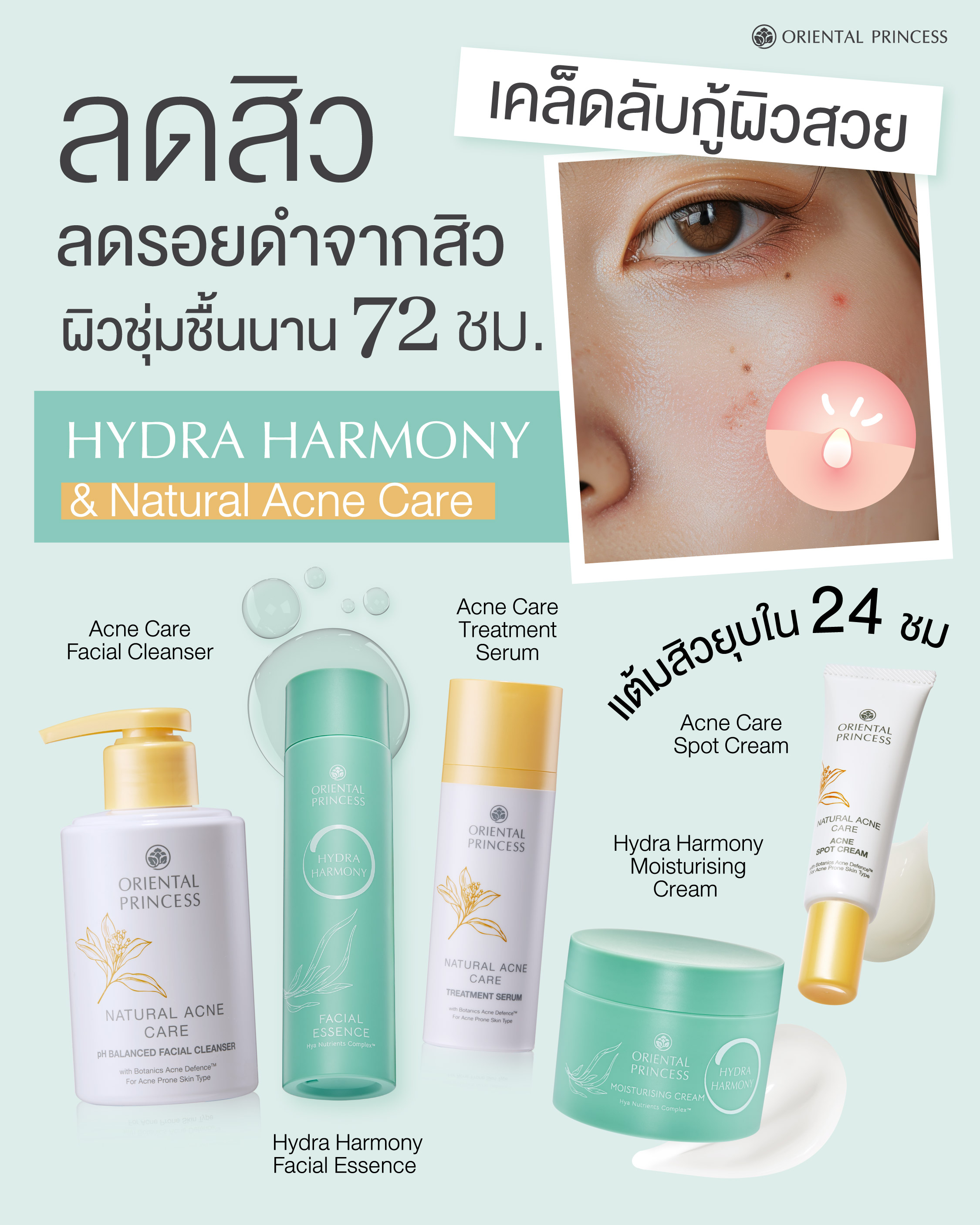 ลดสิว ลดรอยดําจากสิว ผิวชุ่มชื้นนาน 72 ชม.