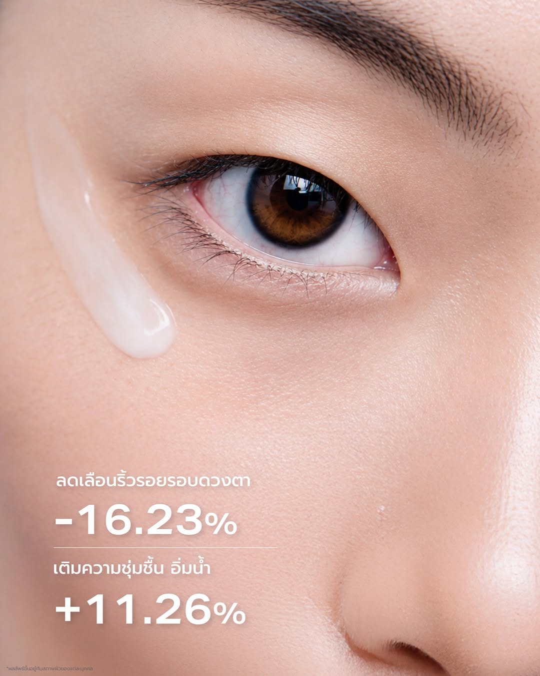 Eye Treatment